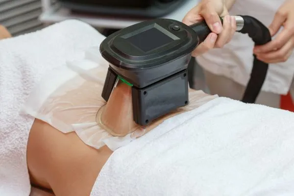 Image of person having fat freezing treatment to help weight gain Bordesley