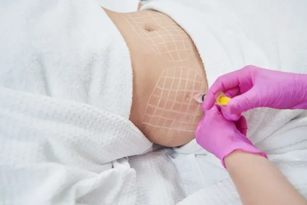image of fat dissolving injections on love handles to help combat weight gain Bordesley