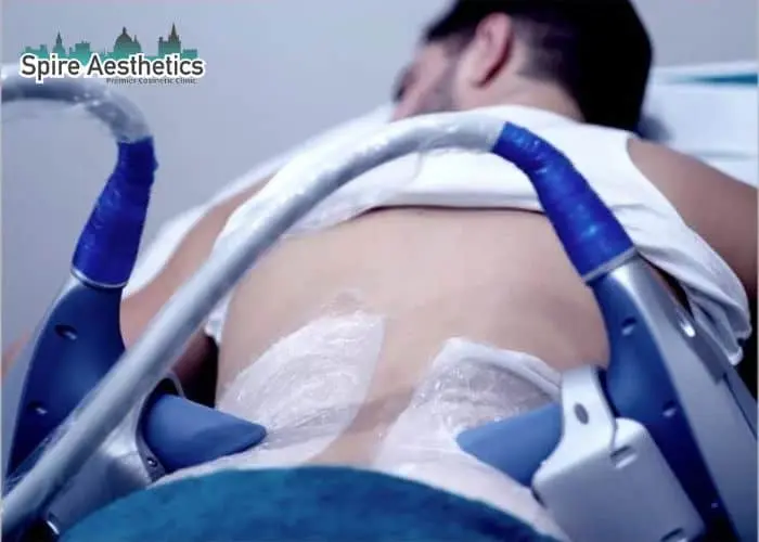 Man having fat freezing treatment done on love handles before a competitions Bordesley to create a sculpted look.